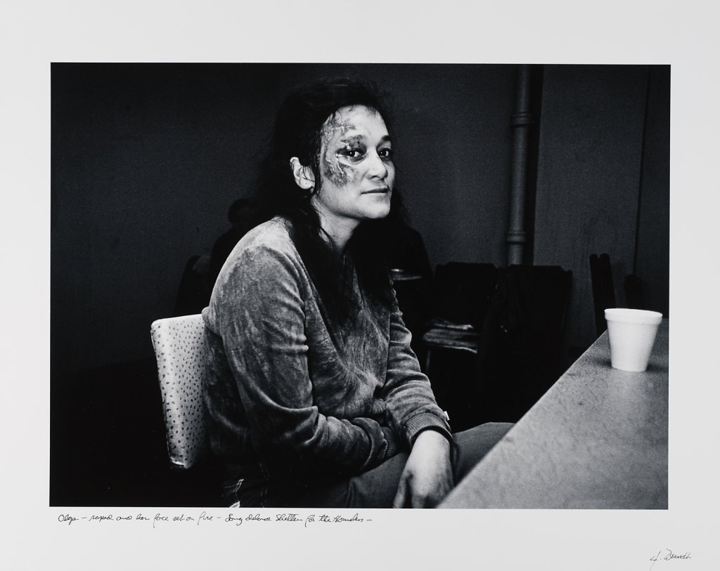 Olga, raped and her face set on fire, Long Island Shelter fot then Homeless, 1983